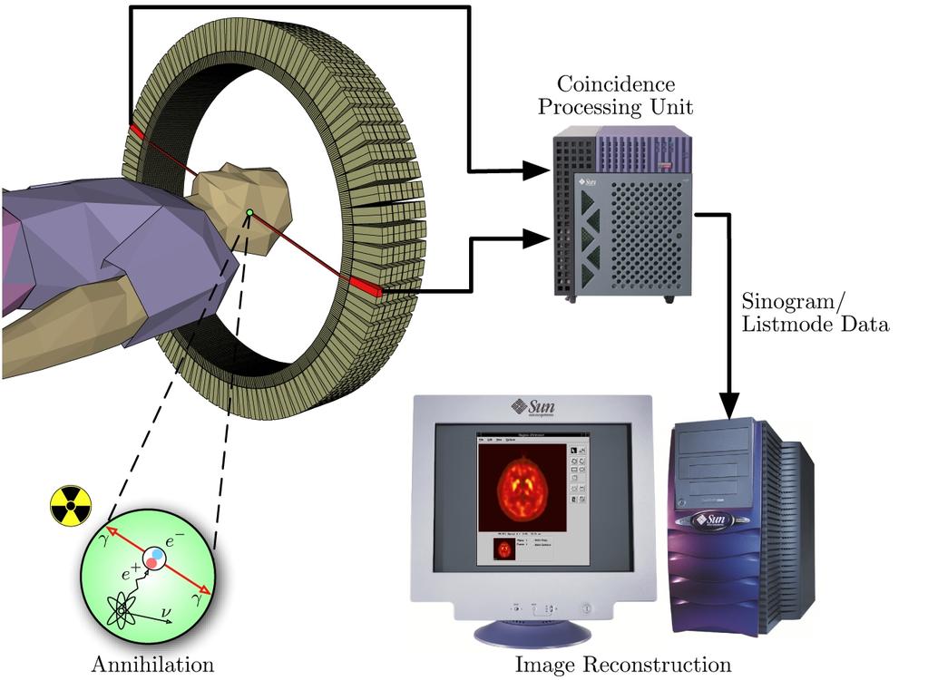 Schéma pozitronové emisní tomografie SPECT (Single-photon emission computed tomography) Principem je podání radiofarmaka vyzařujícího γ záření (nejčastěji 99mTc) a pořízení řady scintigrafických