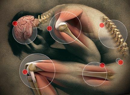 2.7 Diagnostika Vencovský popisuje, že v současné době se používají minimálně upravená kritéria, která popsal Bodan a Peter.