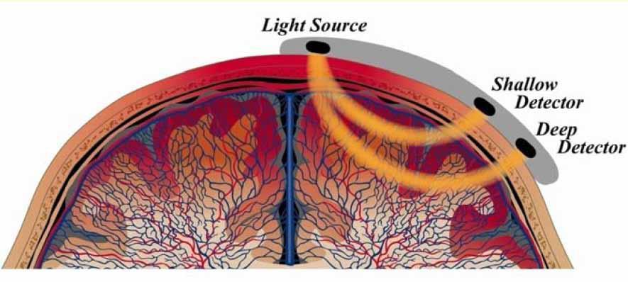 Prostorově cílená cílená spektroskopie Spatially resolved spectroscopy Systém INVOS využívá 2 hloubky