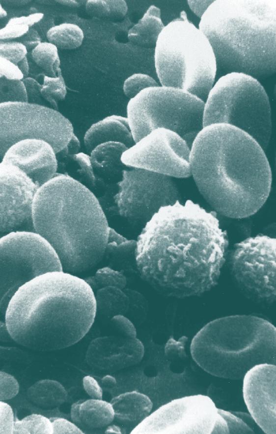 Serologie (Toxo, CMV, HSV, Rubeolla) Plánujete početí potomka a slyšela jste o infekcích, které mohou poškodit plod?