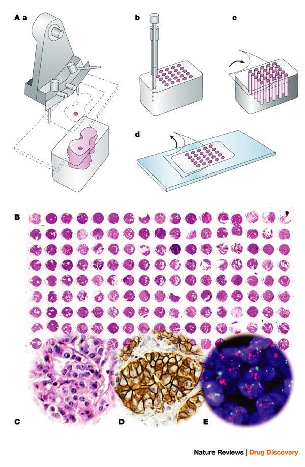 Tkáňové čipy Varianta RPA čipů (zpětný formát) Spotují se celé vzorky tkání