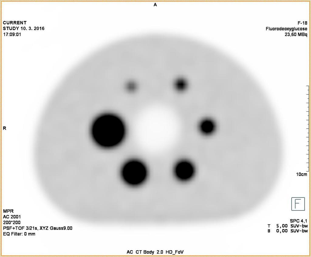 Efekt částečného objemu (PVE) 37 mm 10 mm 13 mm 17 mm 28 mm 22 mm 37 mm 10 mm 13