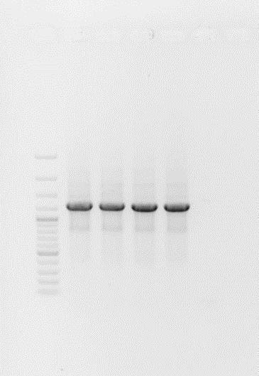 vzorků zaznamenejte do protokolu; do první jamky pipetujte standard molekulové váhy (GeneRuler 100+ bp DNA Ladder). Zapojte zdroj elektrického proudu (černý vodič -, červený + ).