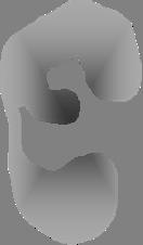 H2 O 2 OH - DCF Example: Neutrophil