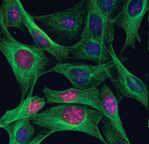Aplikace Click-IT (Invitrogen) Multiplex imaging with Click-iT RNA assays. NIH3T3 cells were incubated with 1 mm EU, formaldehyde-fixed, and permeabilized with Triton X-100.