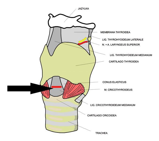 Příloha A Místo provedení tracheostomie B-und-p.com [online]. 2015 cit. [2015-4-10].