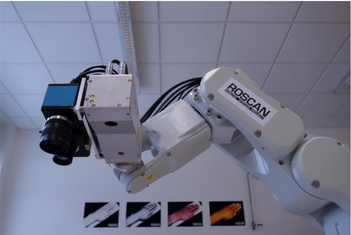 3.2 Nastavení RoScan Pro robotické rameno RoScan bylo potřeba vymyslet vhodnou trajektorii pohybu, aby byla nasnímána požadovaná část kolene v dostatečné kvalitě a v dobrém rozlišení.