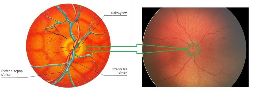 Optický disk je kruhový terč podobající se elipse nebo kruhu. Průměr disku bývá přibližně 1,76 ± 0,3 mm (horizontálně) a 1,92 ± 0,3 mm (vertikálně).