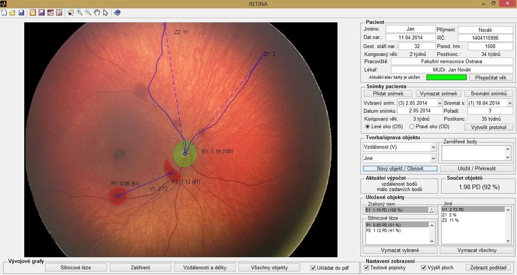 7 Popis uživatelského rozhraní RETINA_0.