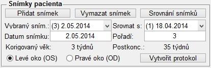 Každý snímek zobrazený v softwaru, uložený do karty pacienta, nese kromě jiných ID informací, také informaci, zdali se jedná o levé nebo pravé oko sítnice.