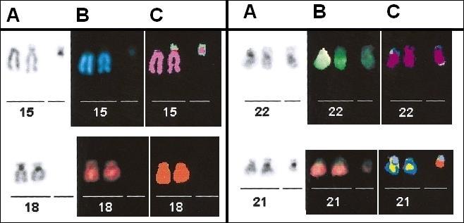 Analýza M-FISH vybraných chromosomů A) G-pruhování; B) reálné barvy; C) klasifikační pseudobarvy - upraveno dle Uhrig et al. 1999 3.