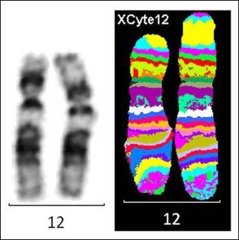 dochází ke snižování intenzity fluorescence směrem k okraji signálů a následným pozorovatelným změnám intenzity fluorescenčních signálů podél svislé osy chromosomů.