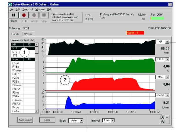 2.4.1 Přenos dat z monitoru Datex Ohmeda K získání a uložení dat z pacientského monitoru Datex Ohmeda byl využit notebook s předinstalovanou aplikací Datex-Ohmeda S/5 Collect.