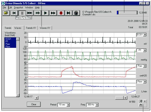 Matlab. Ukládání dat do počítače je zajištěno připojením přes sériový port nebo lze také ukládat pomocí síťového připojení Datex-Ohmeda S/5.