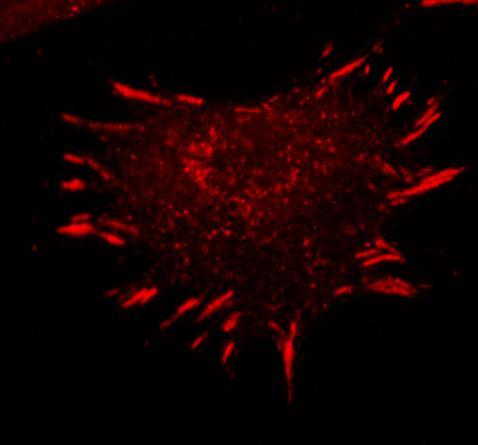 Figure 2.1: Immunofluorescence visualization of focal adhesions in mouse embryonic fibroblasts. The cells were grown on fibronectin and stained with anti-phosphotyrosine to mark FA.