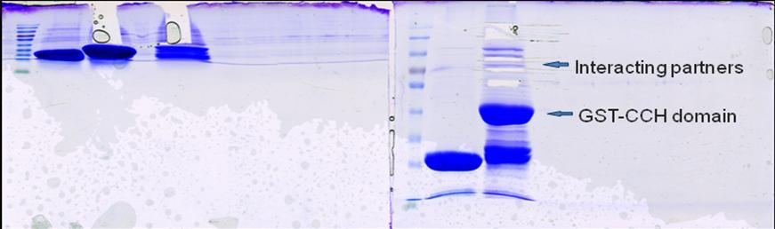 Aspirate ACN and add 90 µl of H 2 O for protein rehydration, vortex strongly. Aspirate water and add 90 µl of ACN, vortex strongly.
