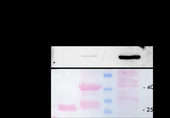 3 CAS CCH domain interaction with FAK and vinculin Garron et al., were studying the C-termini of CAS family proteins by three different approaches: biochemical, biophysical and computational.