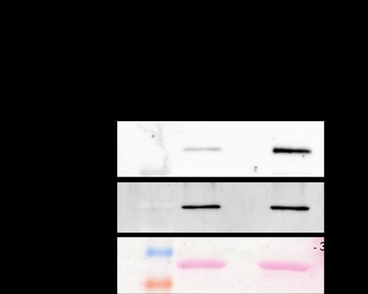 sc-860) and antivinculin (Vinculin (N-19), sc-7649) antibody. Sample with no addition of primary antibody when precipitated was used as a negative control.