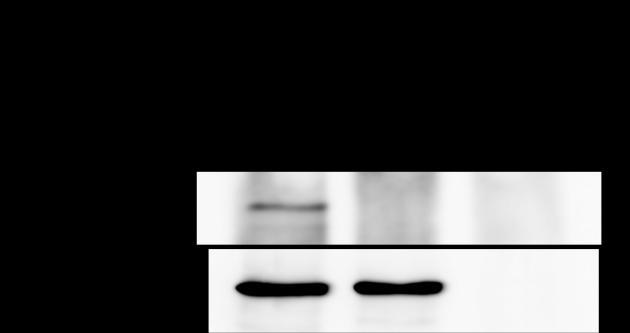 Figure 5.10 The neck region of vinculin containing PxKP motif is important for the interaction with CAS.