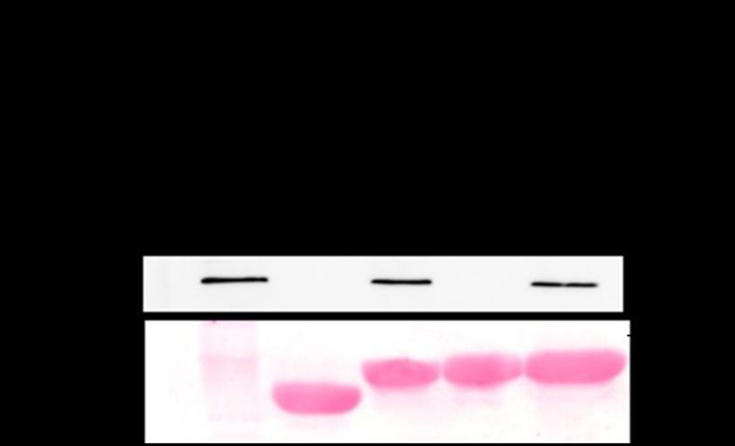 phosphomimiking mutant with almost no detectable vinculin association on nitrocellulose membrane (Figure 5.11A, B).