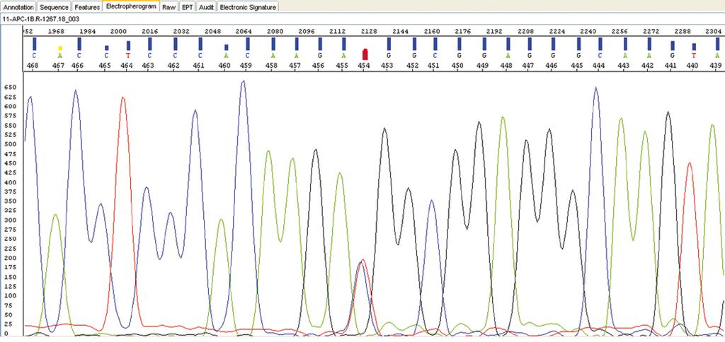 Predictive testing was offered by another genetic clinic to two children, aged 10 and 7, respectively. There are no guidelines about predictive testing in children.