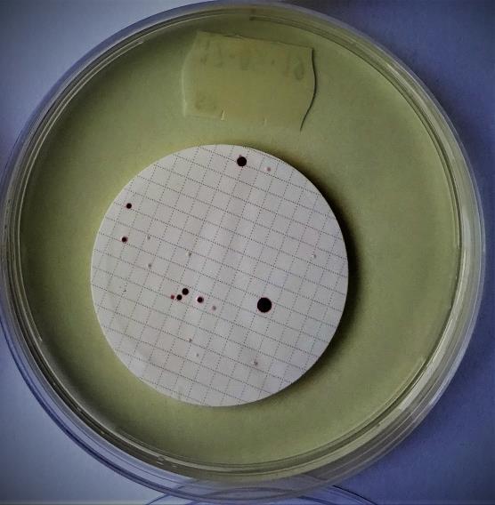 Intestinální enterokoky 12 laboratoří (85 %) uvedlo výrobce. Výsledky jsou poměrně vyrovnané (Himedia 2*, Trios 3*, Rapid Enterococcus agar 1*, Sigma Aldrich 1*, Merck 3*, Oxoid 2*).