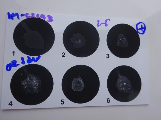 Patogenní bakterie Na rozdíl od bakterií Pseudomonas aeruginosa a Staphylococcus