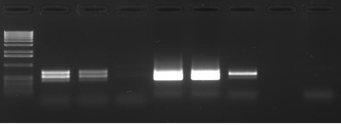 z dodaného vzorku (frakce 2); DNA izolovaná kitem pro bakteriální DNA v přímo dodaném vzorku.