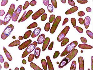 Clostridium difficile Sporulující obligátní anaerob Vysoká odolnost ( zevní vlivy, desinfekce, antibiotika.