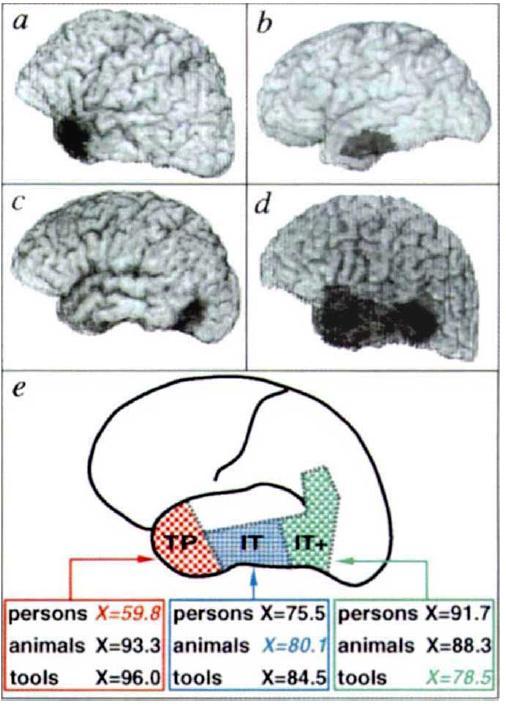 Sémantická paměť v mozku Kategoriální postižení při poruchách mozku rozpoznání obrázků živých vs.