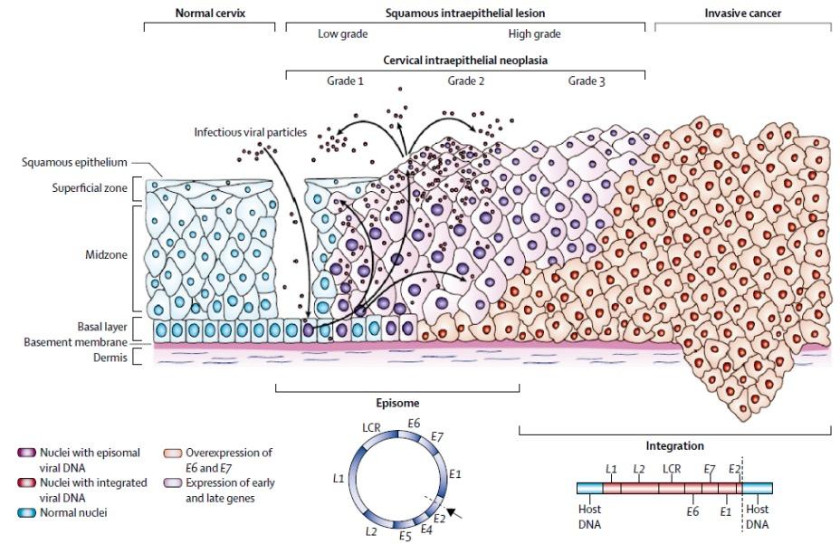 Cohen PA et al. Lancet.