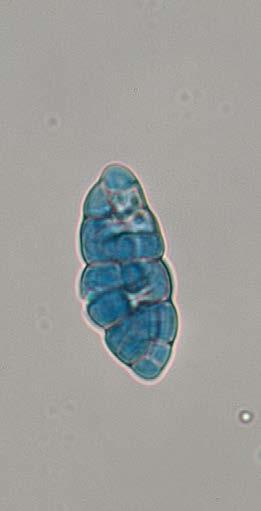 (B) Dead bud covered by layer of blackish perithecia of the sexual stage. (C) Pycnidia of asexual stage Megaloseptoria mirabilis among the scales of withered bud.