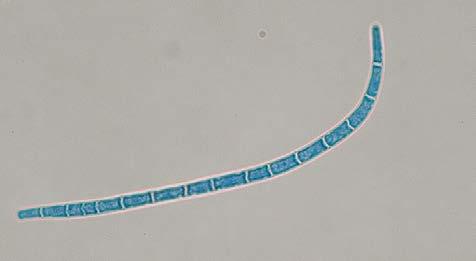 (H) Colony of the pathogen on MEA (after 3 months of cultivation) 6 1.