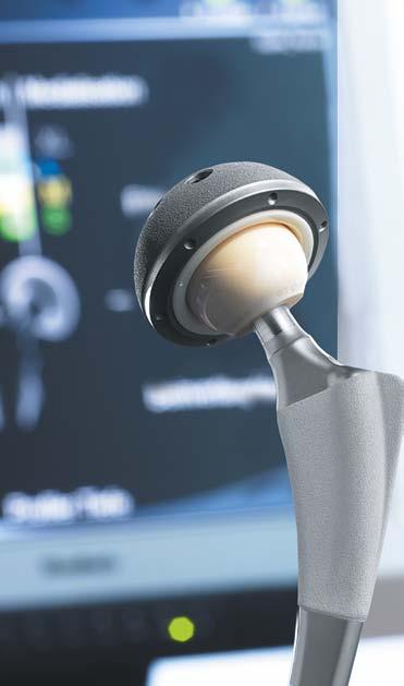 2. Jaké výhody přináší navigační systém OrthoPilot?