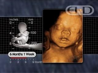 FBMs = fetal breathing-like movements pohyby připomínající dýchání nezbytné pro vývoj plic