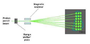 radioterapie s modulovanou intenitou svazku). Proto se tato technika také označuje jako IMPT (Intensity Modulated Proton Therapy).