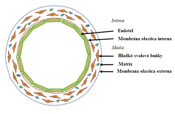Obrázek 3: Počátek vzniku aterosklerotického plátu (21). A.