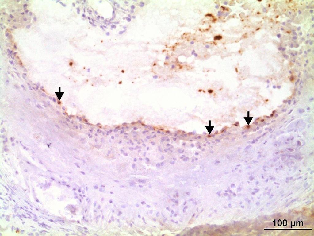 Obrázek 11: Reprezentativní obrázek imunohistochemického barvení