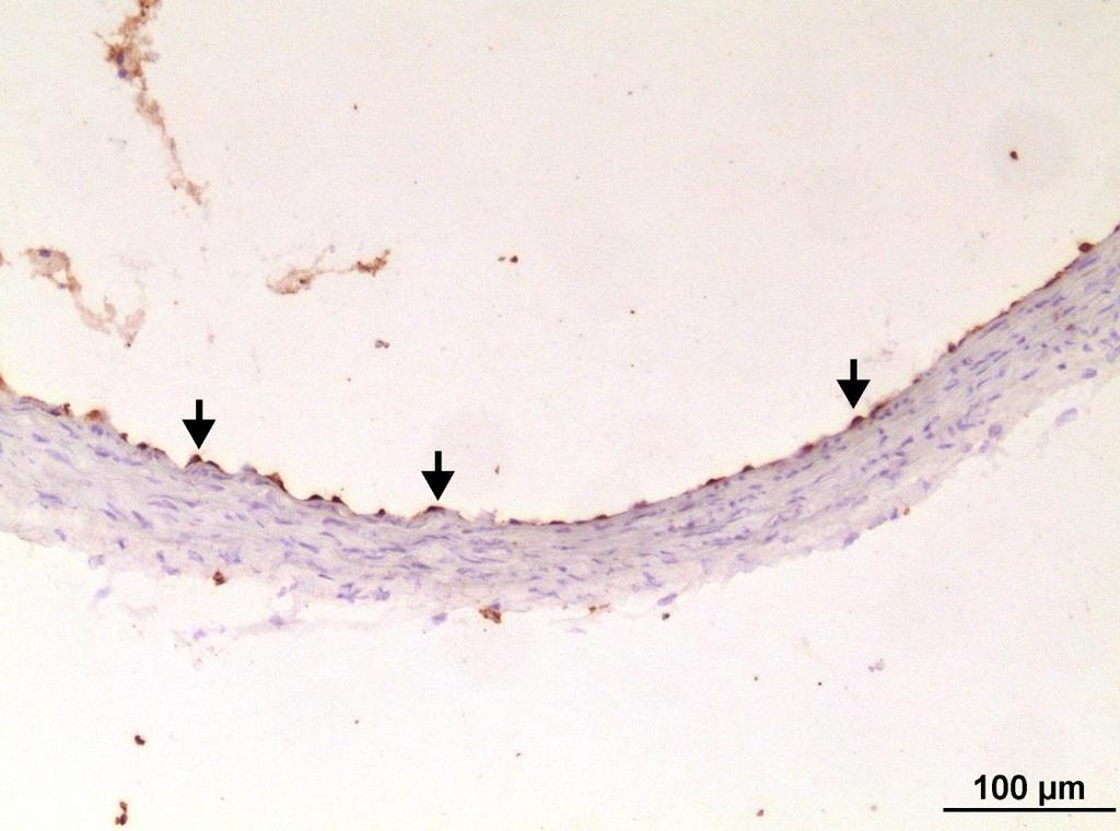 Obrázek 12: Reprezentativní obrázek imunohistochemického barvení