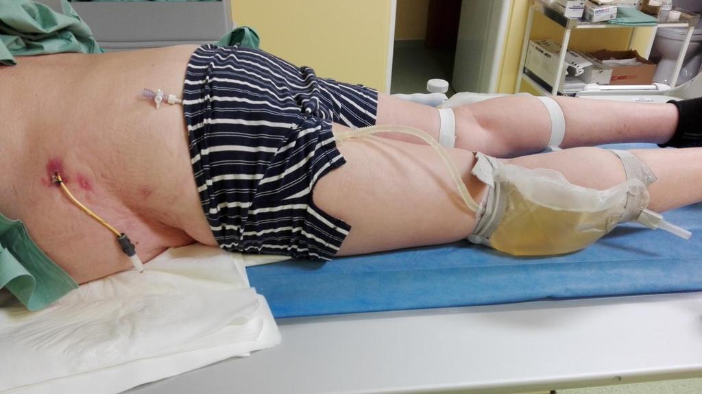 roky si zachovají pozitivní přístup a vnitřní pohodu. Ti také nespadají do skupiny častých akutních kontrol.