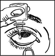 Čistým prstem stáhněte oční víčko tak, aby se mezi očním víčkem a okem vytvořila kapsa, do které budete aplikovat kapku přípravku (obrázek 2). Přibližte se hrotem lahvičky k oku.