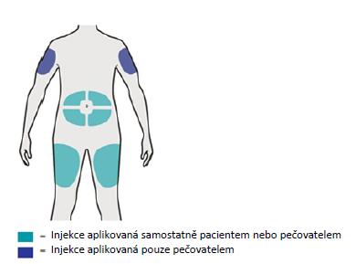 Krok 5: Volba místa vpichu Zvolte místo vpichu. Injekci můžete aplikovat do stehna nebo do břišní krajiny - s výjimkou oblasti 5 cm kolem pupku.