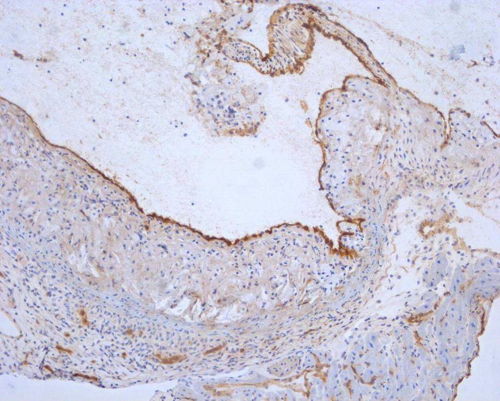 9 Obrázek: Imunohistochemické barvení endoglinu.