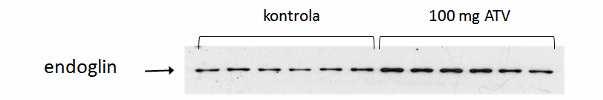 5.3 Western Blot analýza 5.3.1 Western blot analýza exprese endoglinu Western blot analýza exprese endoglinu měla za cíl prokázat celkovou expresi endoglinu ve