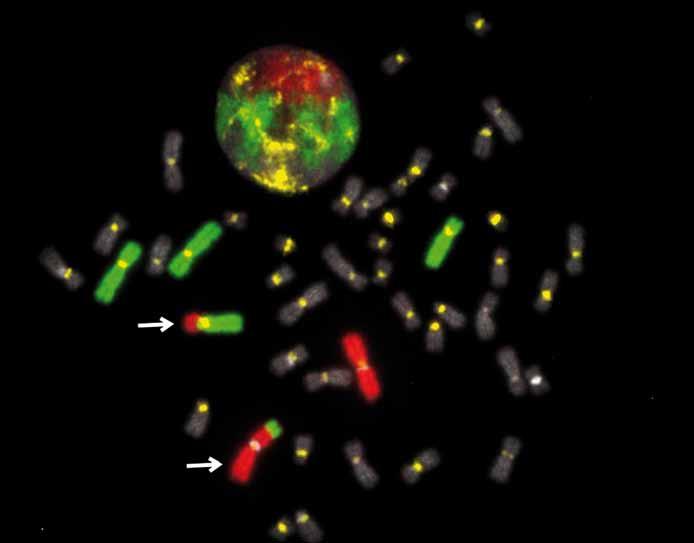 ridization CGH), mnohobarevné karyotypování lidských chromozomů (mfish mband-sky) a mikročipové technologie [4].