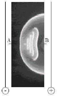 44 (14.1) (14.2) (a) (b) Figure 14: BZ-wave splitting. (14.1) Schematic one-dimensional concentration profiles of three important intermediates in BZ system during the course of the wave splitting (from [Šev83]).