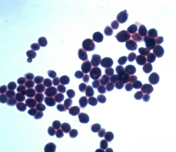 Staphylococcus Foto: archiv