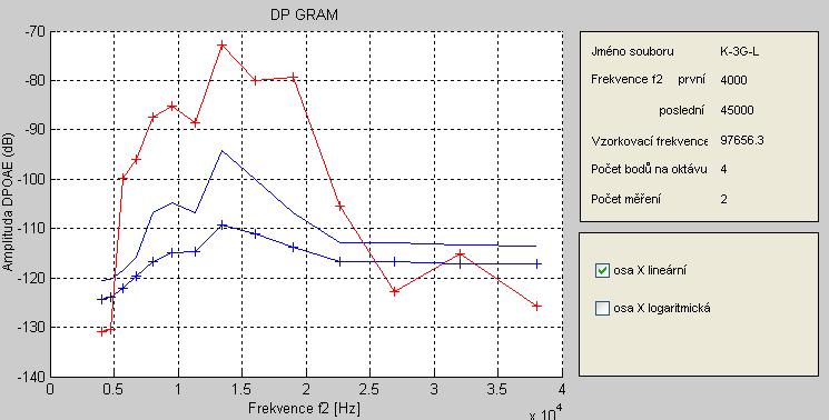 Obr. 5 Ilustrační příklad dvou originálních DP-gramů zkonstruovaných ve vyhodnocovacím programu v programovém prostředí MATLAB.