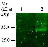 Obr. 4.1.2.2.: Inhibiční specifita proteolytické aktivity slin.