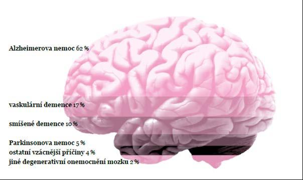 Demence Zdroj: Česká